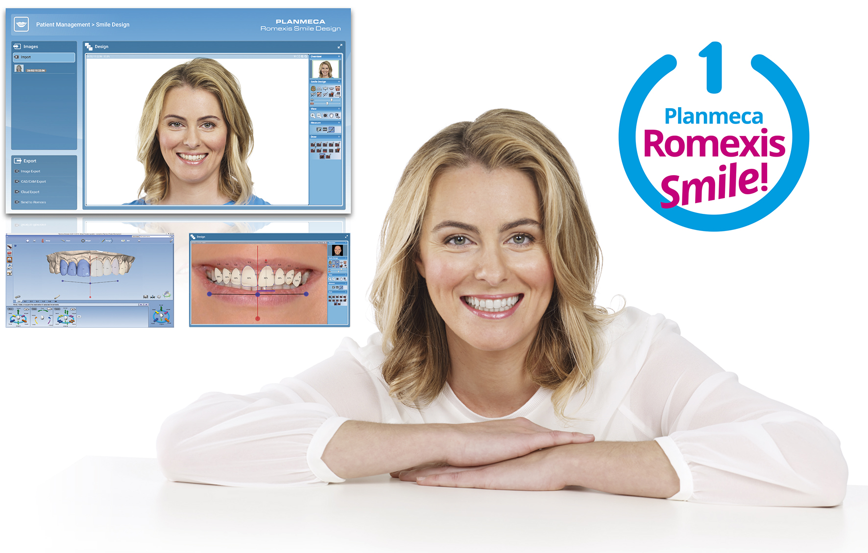 Planmeca Romexis® Smile Design gibt den Zahnärzten die Möglichkeit, ihren Patienten ein neues harmonisches Lächeln zu verschaffen