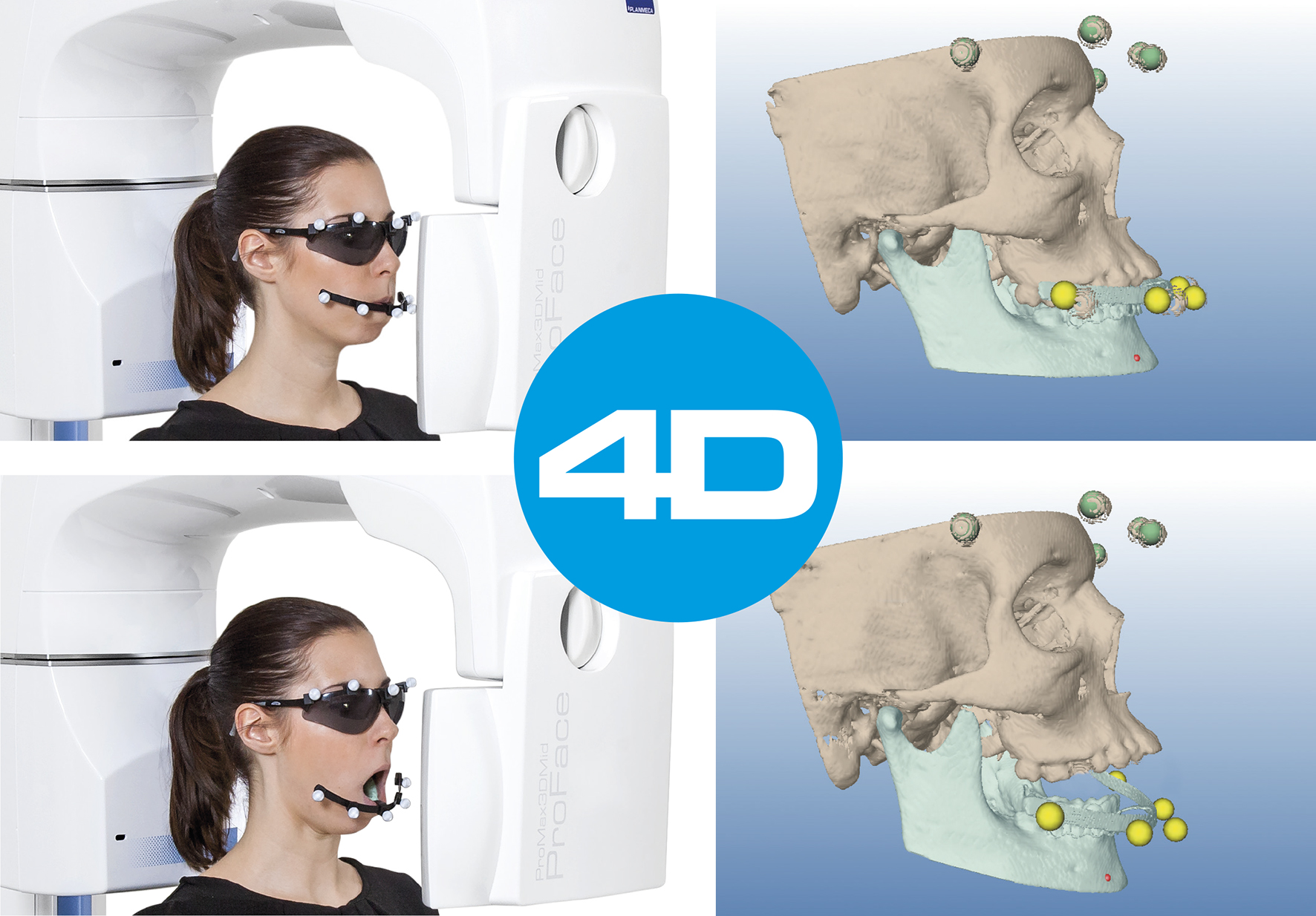 Planmeca анонсировала новейшую систему отслеживания движения челюсти Planmeca 4D™ Jaw Motion