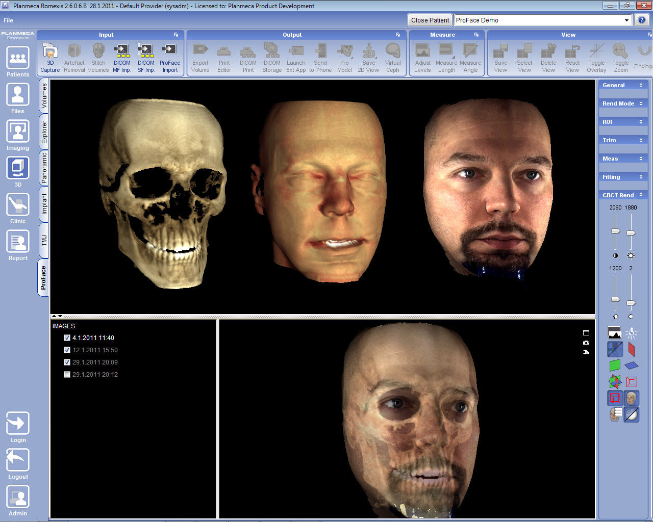 Das neue Planmeca ProMax 3D ProFace System ermöglicht eine sicherere und schnellere Gesichtschirurgie