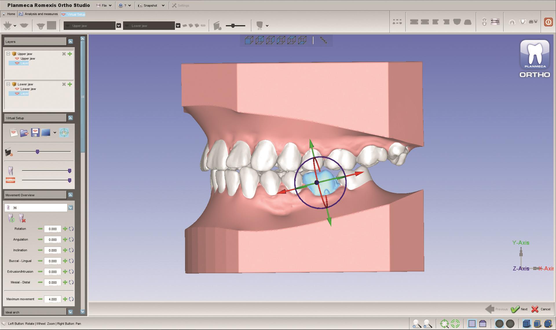 Planmeca esittelee uusia 3D-työkaluja oikomishoidon hammaslääkäreille ja hammaslaboratorioille