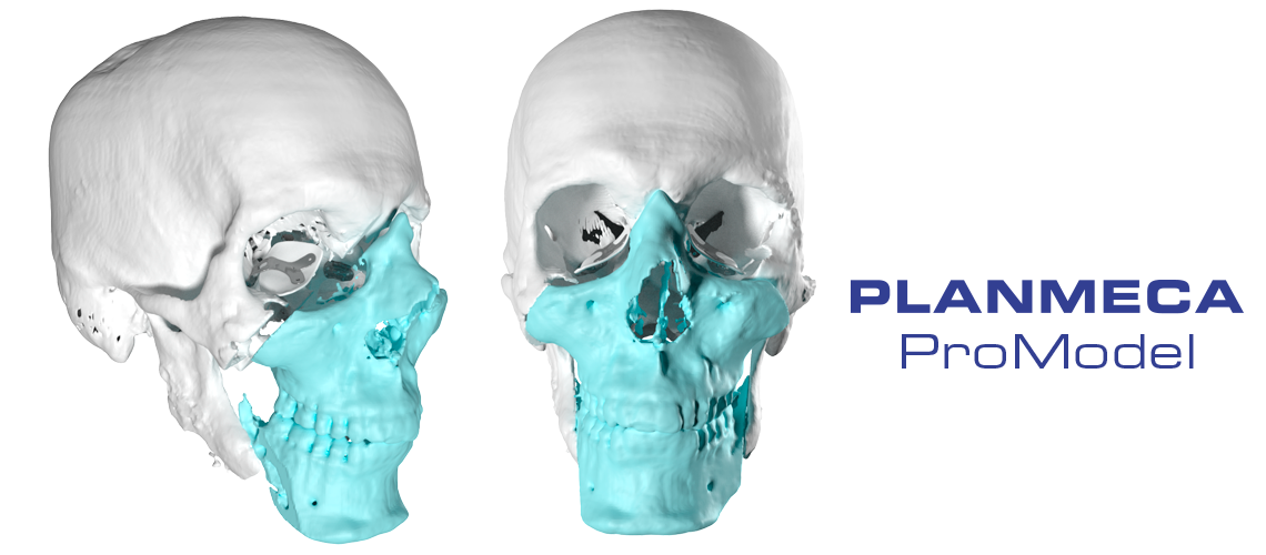 Une opération de greffe de tissu facial témoigne des avancées en matière de chirurgie et de la technologie de pointe