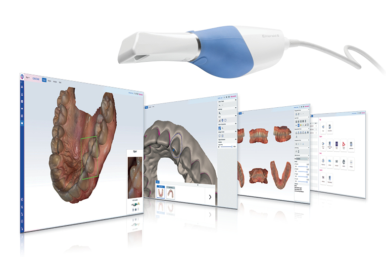 Программный модуль Planmeca Romexis® CAD/CAM: новый уровень удобства работы с цифровыми оттисками