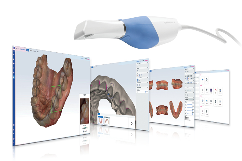 El módulo Planmeca Romexis® CAD/CAM lleva las impresiones digitales a un nivel superior