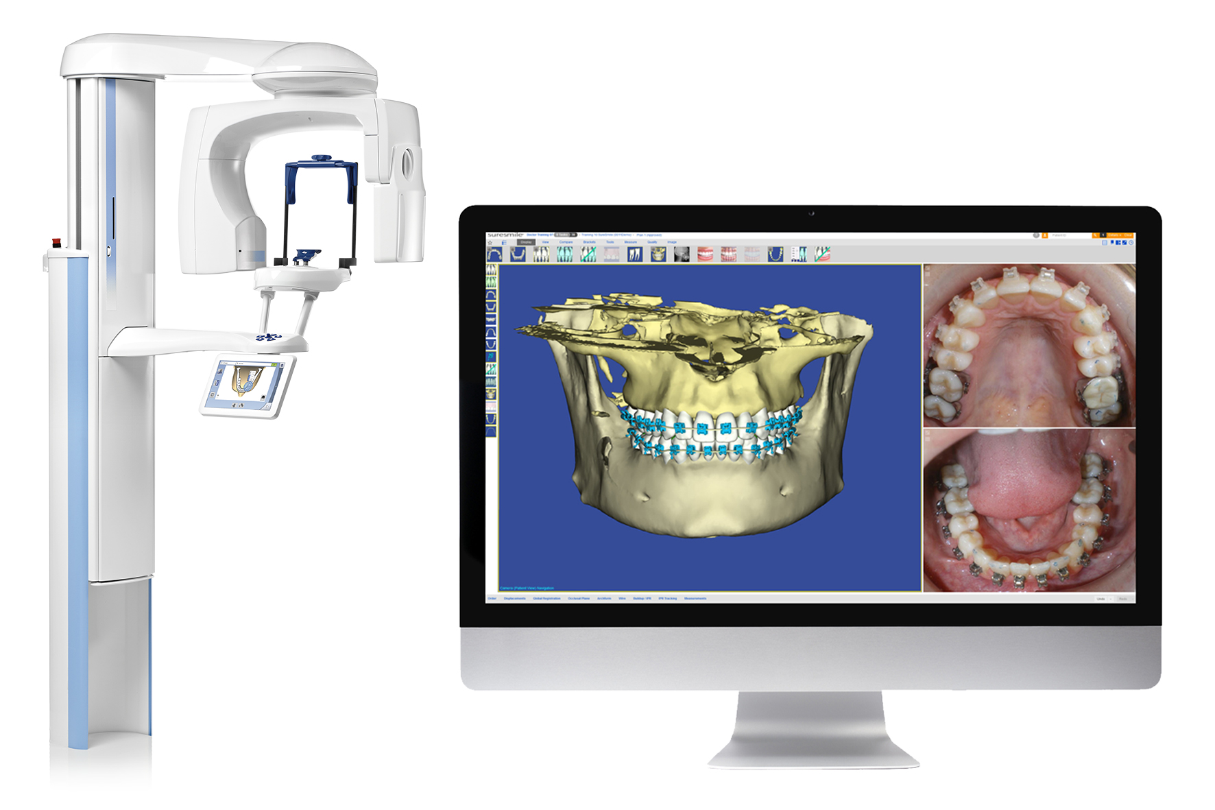 Les dispositifs Planmeca ProMax® 3D Classic, Mid et Max sont désormais homologués pour l'utilisation avec suresmile