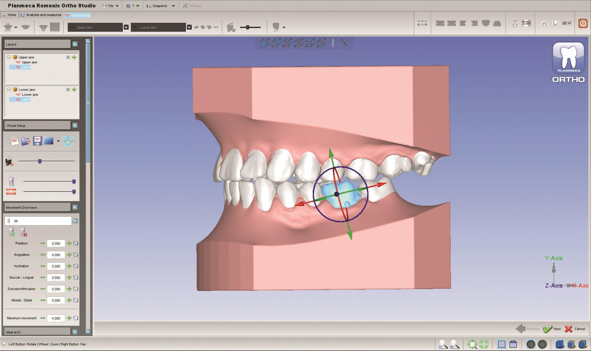 Planmeca führt neue 3D-Tools für Kieferorthopäden und Dentallabore ein