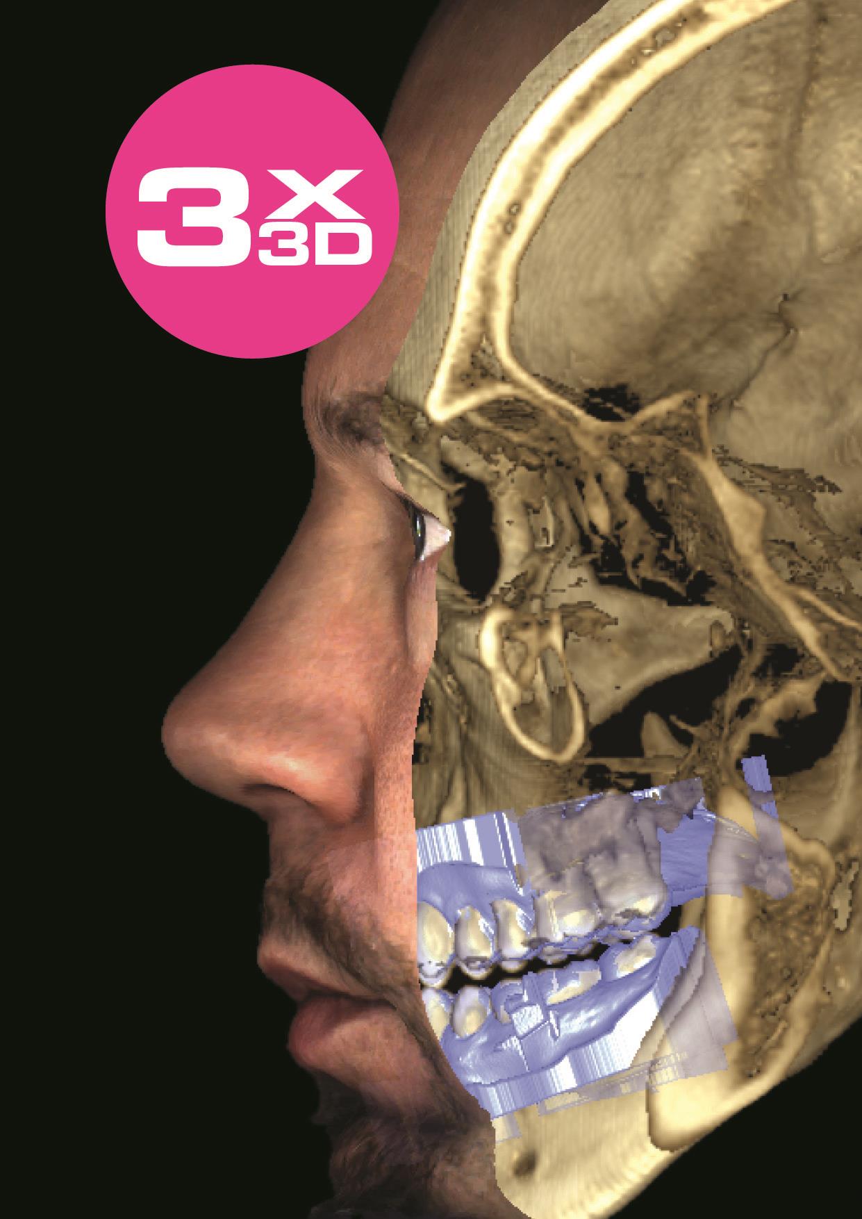 Three types of 3D data with one Planmeca unit