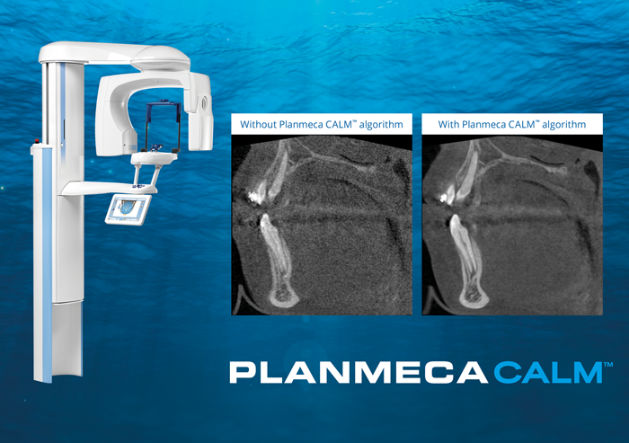 Planmeca CALM™ receives Innovation 2017 honorary mention