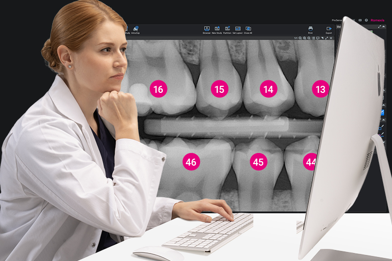 KI-Werkzeuge für die intraorale Bildgebung jetzt in der Software Planmeca Romexis® 7 verfügbar