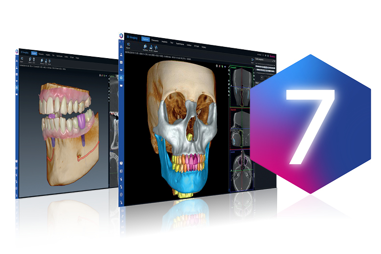 Zahnmedizinische Bildgebungssoftware Romexis® 7 mit integrierter KI jetzt verfügbar