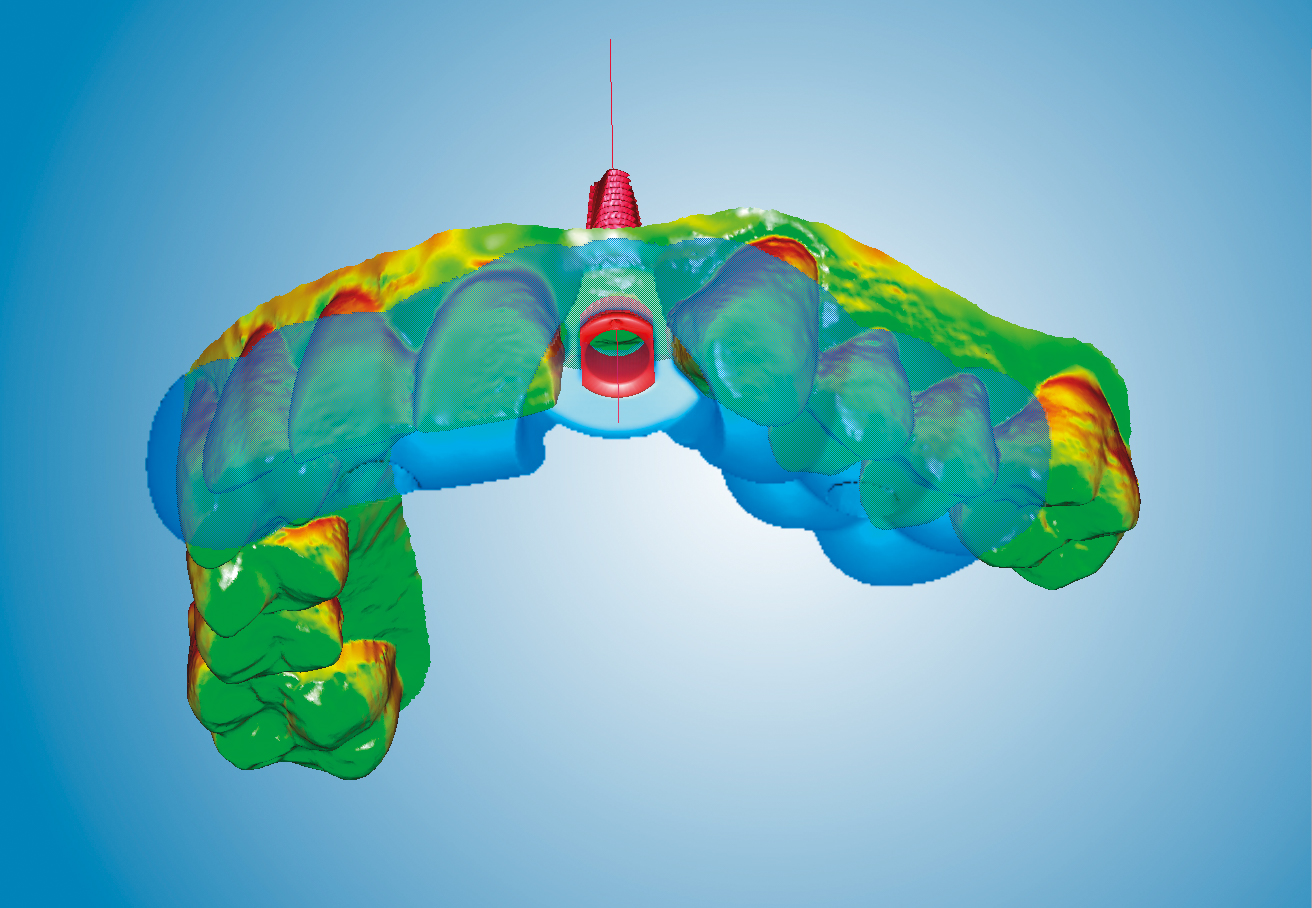 Implanting a new workflow