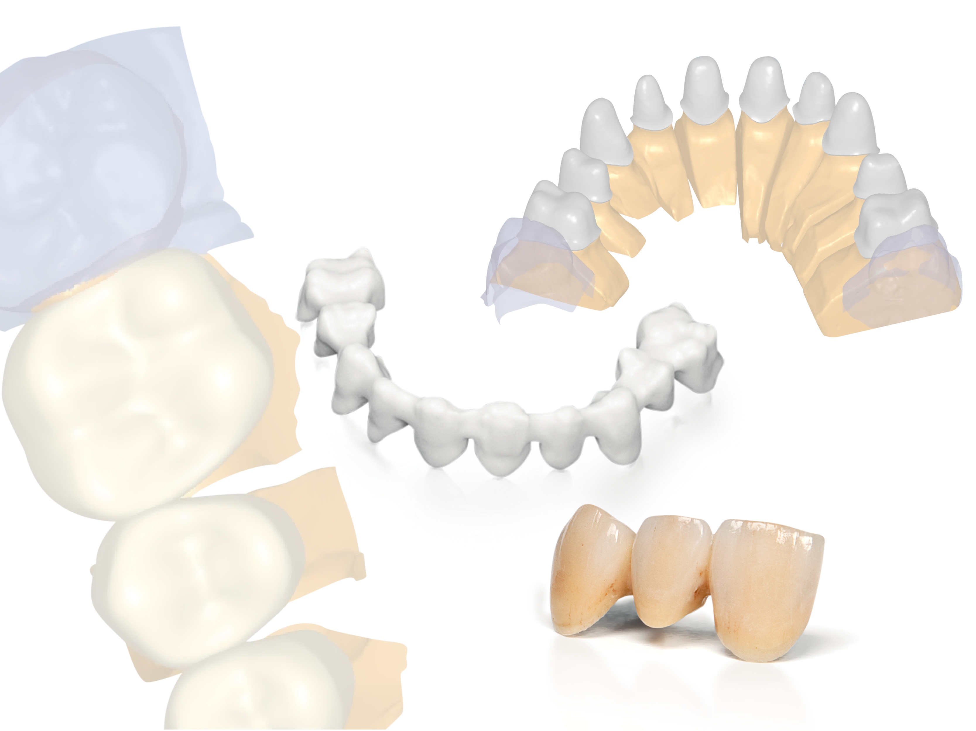 Nouvelles solutions ouvertes CAD/CAM Planmeca pour les dentistes et les laboratoires dentaires