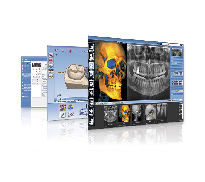 Planmeca Romexis® – power for all specialties