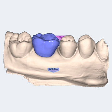 CAD/CAM software Planmeca PlanCAD Easy