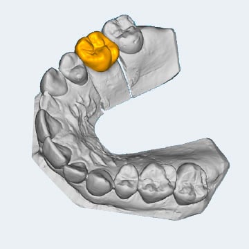 CAD/CAM Software Planmeca PlanCAD Premium