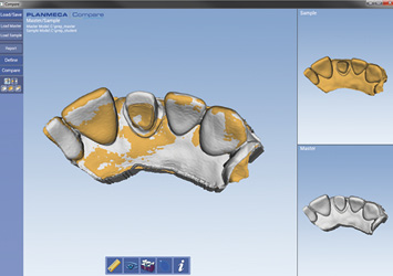 Workflow with Planmeca Romexis Compare Compare