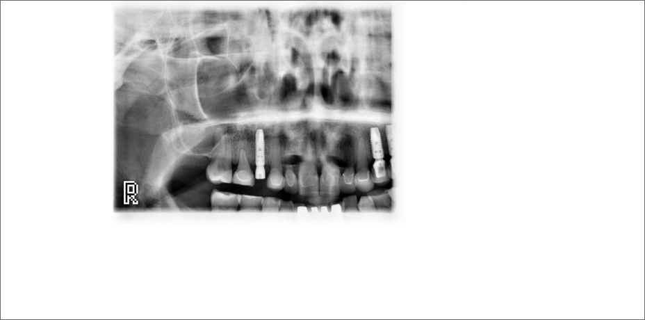ProMax 2D clinical images horizontal and vertical segmenting
