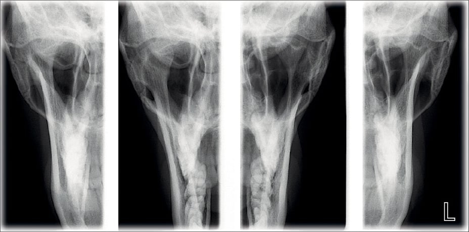 ProMax 2D clinical images PA TMJ
