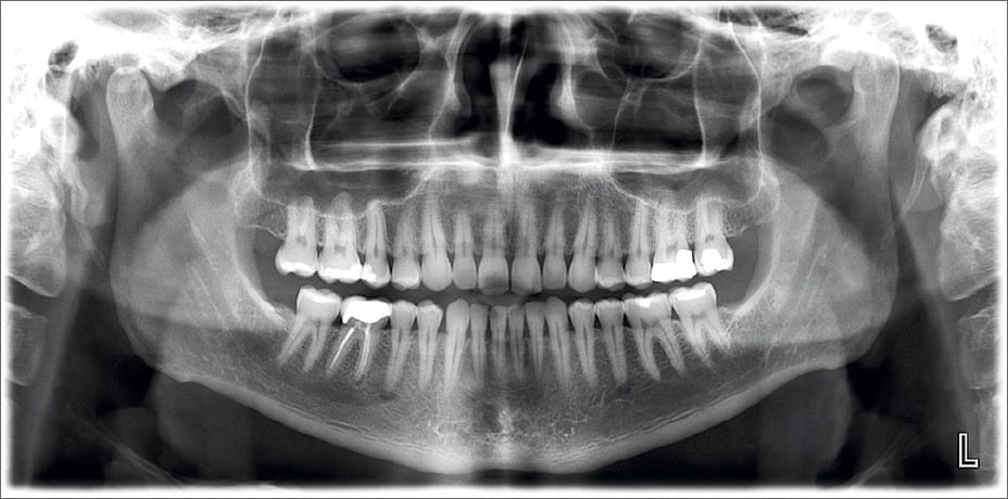 ProMax 2D clinical images standard panoramic