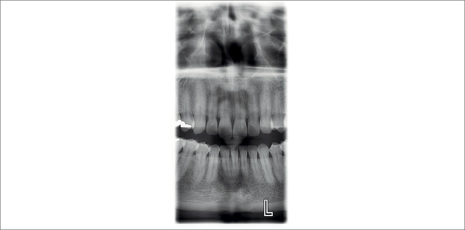 ProMax 2D clinical images horizontal and vertical segmenting