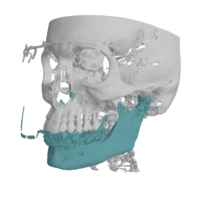 Planmeca 4D Jaw motion
