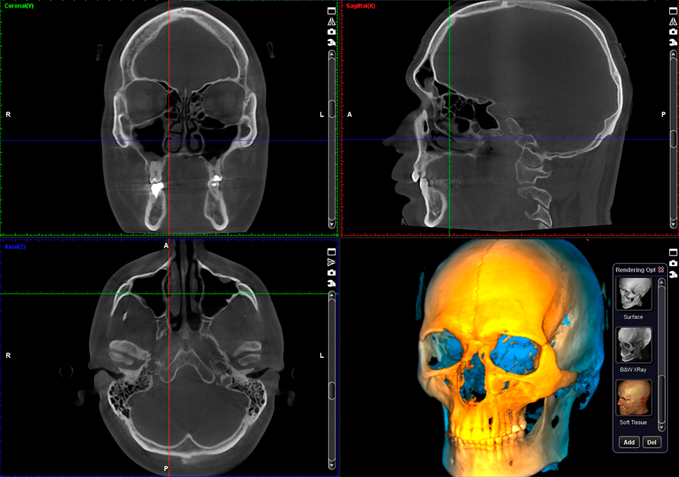 ProMax 3D Max full skull