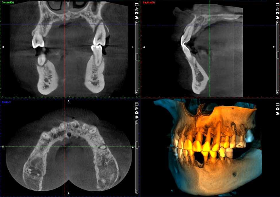 Planmeca ProMax 3D s large view image