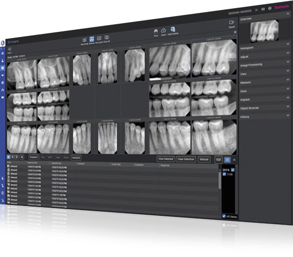 Intraoral sensor Planmeca ProSensor HD