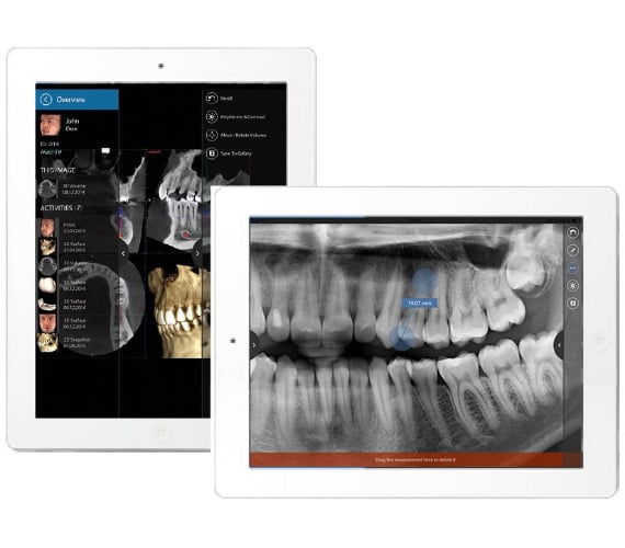 Planmeca mRomexis portable image viewer
