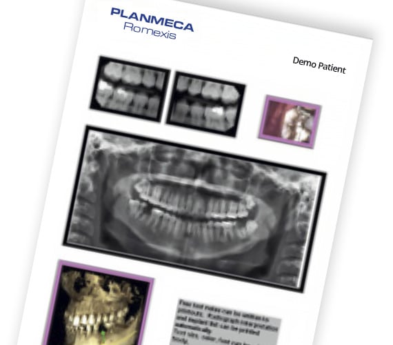 Planmeca Romexis 2D imaging report