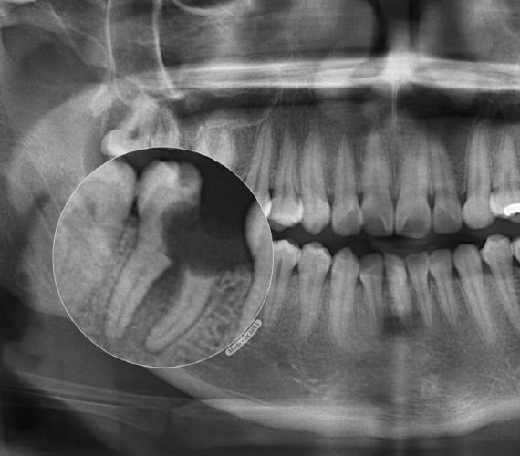 Planmeca Romexis 2D module close up