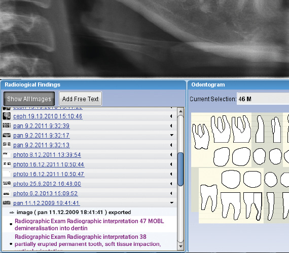 Planmeca Romexis 2D radiological findings