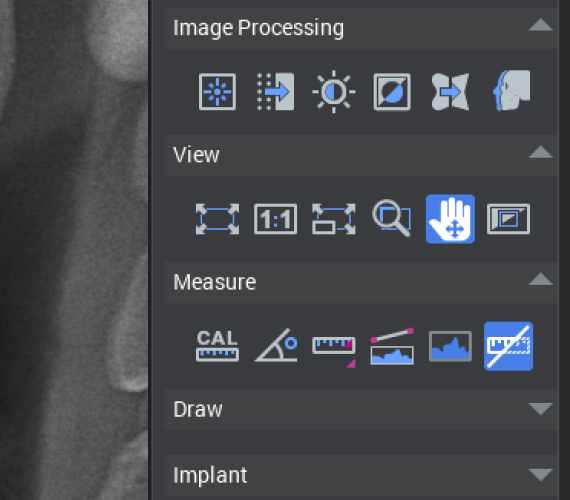 Planmeca Romexis 2D software menu