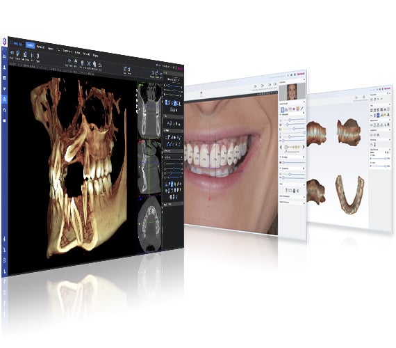 Planmeca Romexis 2D software screenshots