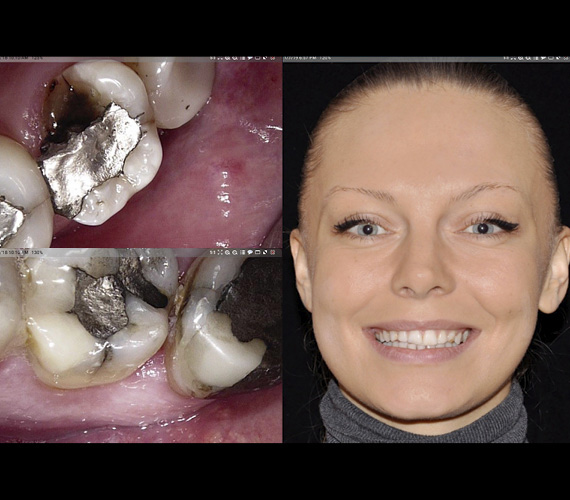 Planmeca Romexis 2D software storage