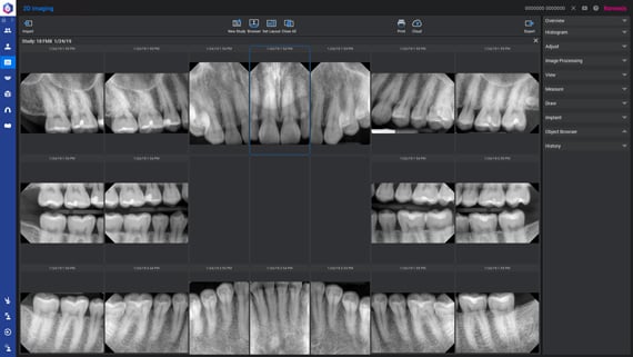 Planmeca Romexis 2D intraoral imaging workflow