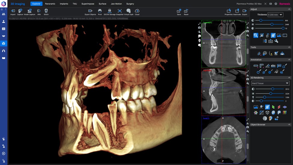 3D imaging software Planmeca Romexis
