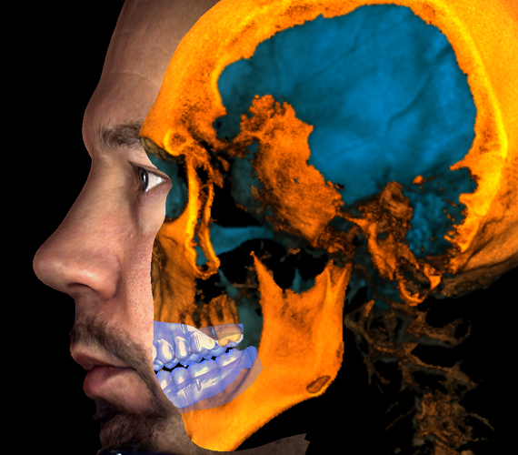 Planmeca Romexis for all 3D images