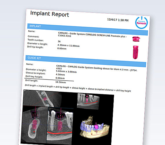 Planmeca Romexis implant report