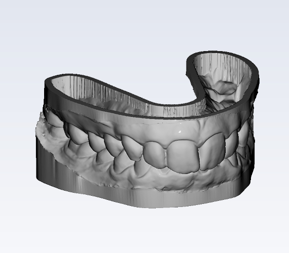 Planmeca Romexis Model Analyser 3D model