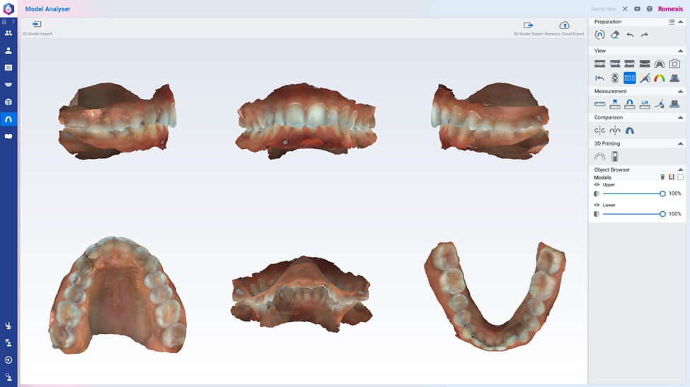 Planmeca Romexis model analyser samples