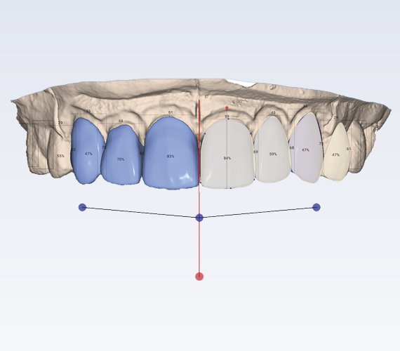 Planmeca Smile Design CAD/CAM clear