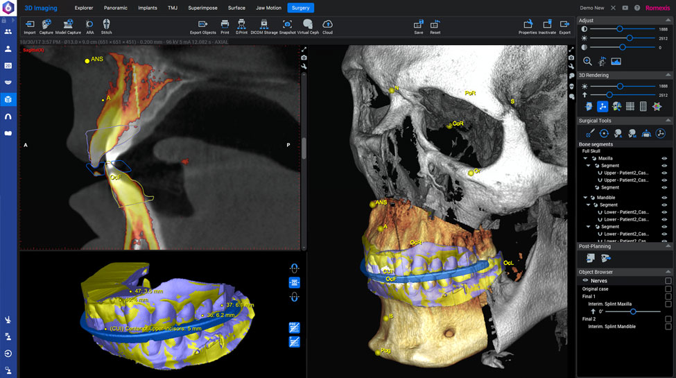 Planmeca Romexis Surgery