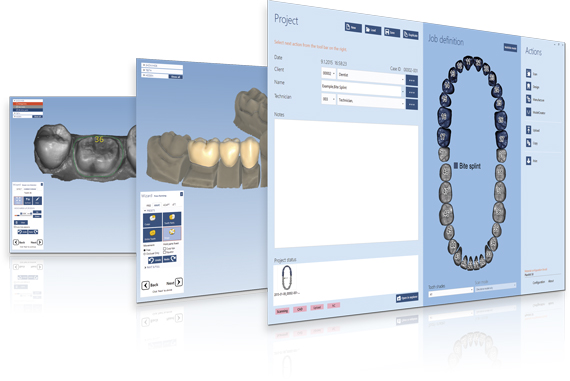 cad cam for dental labs planmeca lab cam