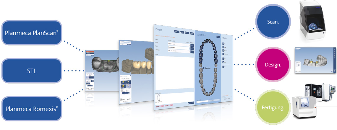 CAD/CAM Lab-Lösung für Dentallabore