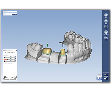 Planmeca PlanCAD Premium