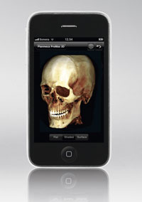 Planmeca iRomexis application for iPhone