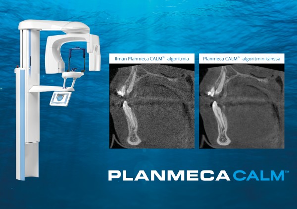 Planmeca CALM