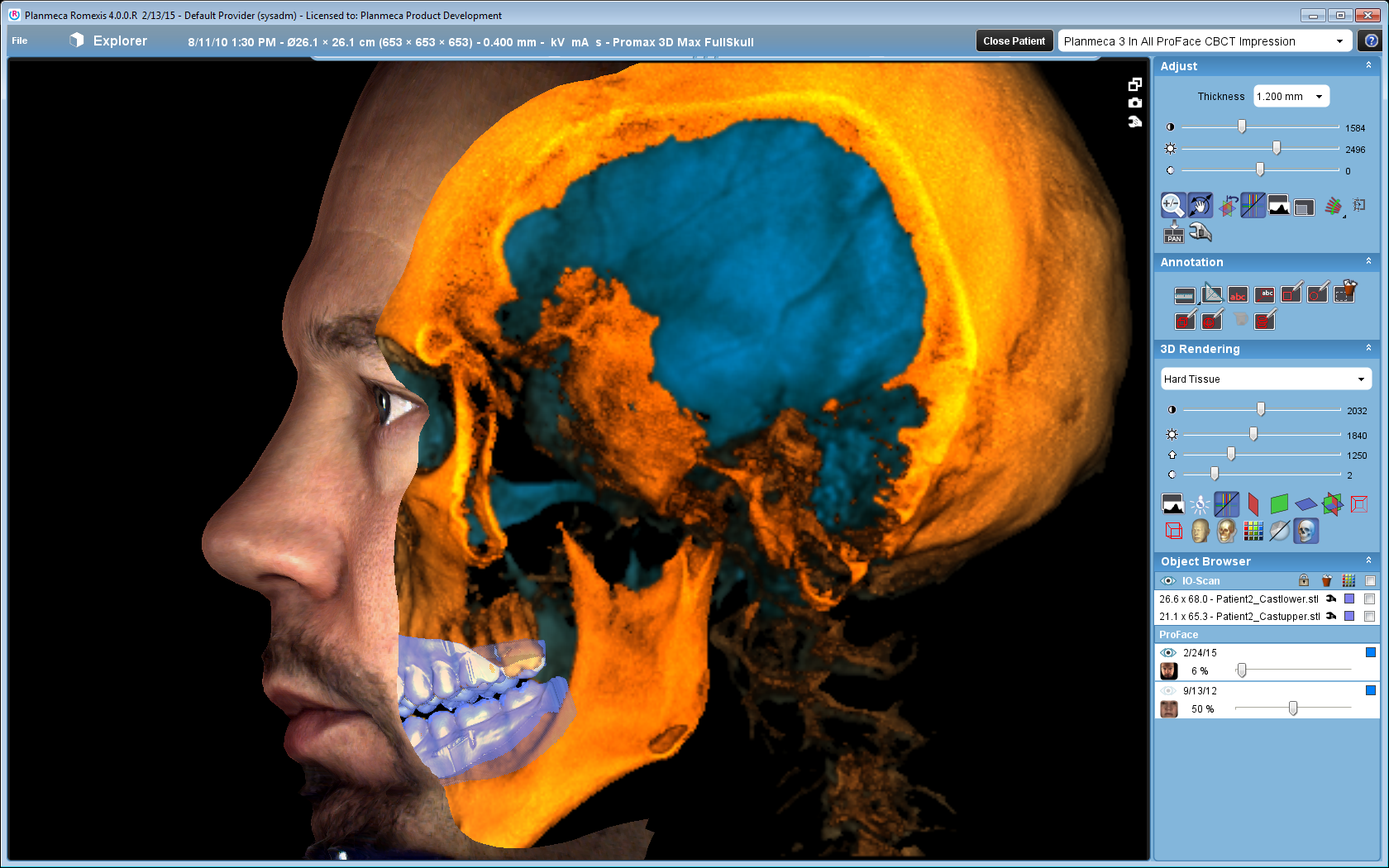 Planmeca virtual patient Planmeca virtual patient