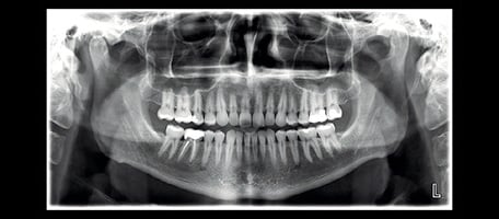 Planmeca ProMax® 2D S3 panoramic X-ray unit