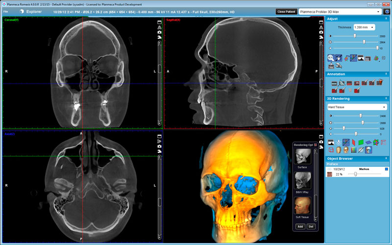 Planmeca ProMax 3D Max full skull
